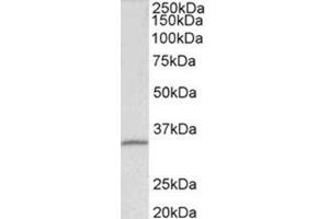 Western Blotting (WB) image for anti-Fibrillarin (FBL) (Internal Region) antibody (ABIN1107199) (Fibrillarin antibody  (Internal Region))