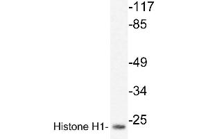 Western blot (WB) analyzes of Histone H1oo antibody in extracts from HUVEC cells. (Histone H1 antibody)