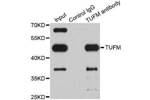 Immunoprecipitation analysis of 200ug extracts of Jurkat cells using 1ug TUFM antibody. (TUFM antibody  (AA 186-455))