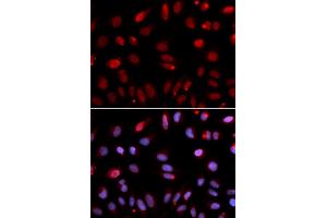 Immunofluorescence (IF) image for anti-HUS1 Checkpoint Homolog (S. Pombe) (HUS1) antibody (ABIN1876595) (HUS1 antibody)