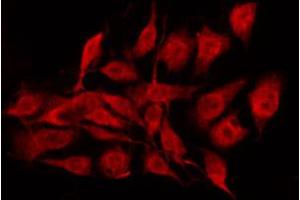 ABIN6267352 staining MCF7 by IF/ICC. (Bcl-2 antibody  (pSer70))