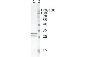 Western Blot testing of HIV-1 recombinant Nef protein. (HIV-1 Nef (AA 35-50) antibody)