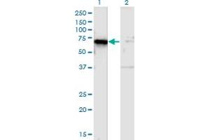 Western Blot analysis of TSPYL1 expression in transfected 293T cell line by TSPYL1 monoclonal antibody (M01), clone 4F11. (TSPYL1 antibody  (AA 1-100))