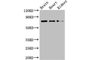 Western Blot Positive WB detected in: Mouse brain tissue, Mouse heart tissue, Mouse kidney tissue All lanes: PDIA4 antibody at 4 μg/mL Secondary Goat polyclonal to rabbit IgG at 1/50000 dilution Predicted band size: 73 kDa Observed band size: 73 kDa (PDIA4 antibody  (AA 101-400))
