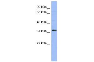 WB Suggested Anti-TLX1 Antibody Titration:  0. (TLX1 antibody  (N-Term))