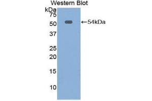 Western Blotting (WB) image for anti-Mesothelin (MSLN) (AA 400-615) antibody (ABIN1859885) (Mesothelin antibody  (AA 400-615))