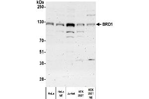 anti-Bromodomain Containing 1 (BRD1) (AA 750-800) antibody