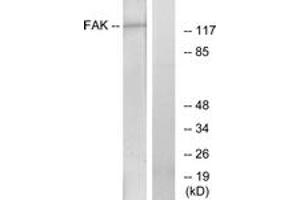 Western blot analysis of extracts from HeLa cells, treated with Serum, using FAK (Ab-861) Antibody. (FAK antibody  (AA 828-877))