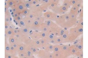 Immunohistochemistry (IHC) image for anti-Hexosaminidase B (Beta Polypeptide) (HEXB) (AA 122-311) antibody (ABIN7438553)