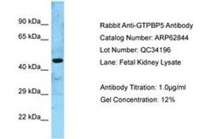 Image no. 1 for anti-GTP Binding Protein 5 (GTPBP5) (AA 130-179) antibody (ABIN6749955) (GTPBP5 antibody  (AA 130-179))