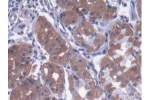 Detection of MTX1 in Human Stomach Tissue using Polyclonal Antibody to Metaxin 1 (MTX1) (Metaxin 1 antibody  (AA 175-387))