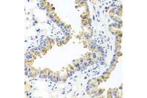 Immunohistochemistry of paraffin-embedded mouse lung using HSPA6 antibody. (HSPA6 antibody  (AA 474-643))