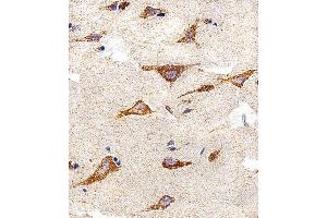 Immunohistochemical analysis of paraffin-embedded H. (IDH3B antibody  (N-Term))