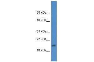 WB Suggested Anti-XAGE2 Antibody Titration: 0.