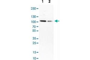 Western Blot analysis of Lane 1: MCF-7 and Lane 2: HepG2 cell lysates with HMGCR monoclonal antibody, clone CL0259 .