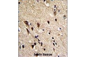 Formalin-fixed and paraffin-embedded human brain reacted with TBB1 Antibody, which was peroxidase-conjugated to the secondary antibody, followed by DAB staining. (TUBB1 antibody)