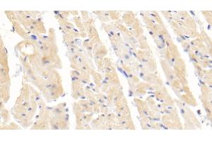 Detection of SOD1 in Rabbit Cardiac Muscle Tissue using Polyclonal Antibody to Superoxide Dismutase 1 (SOD1) (SOD1 antibody  (AA 2-153))