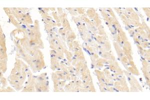Detection of SOD1 in Rabbit Cardiac Muscle Tissue using Polyclonal Antibody to Superoxide Dismutase 1 (SOD1) (SOD1 antibody  (AA 2-153))