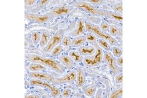 Immunohistochemistry of paraffin-embedded mouse kidney using Caspase-9 Rabbit mAb (ABIN6135366, ABIN7101390, ABIN7101391 and ABIN7101392) at dilution of 1:400 (40x lens). (Caspase 9 antibody)