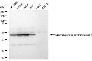 Western blotting analysis using Diacylglycerol O-acyltransferase 1 antibody (ABIN7798329). (Recombinant DGAT1 antibody)