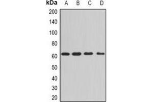 Western blot analysis of PPP3CA expression in Hela (A), A549 (B), mouse brain (C), mouse lung (D) whole cell lysates. (PPP3CA antibody)