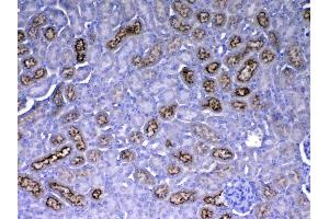 Immunohistochemistry (IHC) image for anti-Retinol Binding Protein 4, Plasma (RBP4) (AA 19-201) antibody (ABIN5519056)