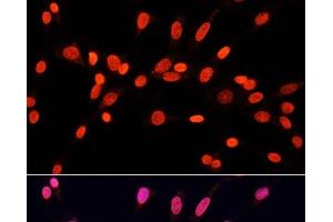 Immunofluorescence analysis of NIH/3T3 cells using DiMethyl-DNMT3A-K44 Polyclonal Antibody at dilution of 1:100. (DNMT3A antibody  (2meLys44))