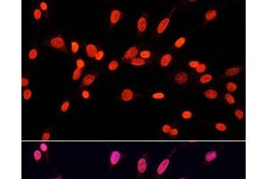 Immunofluorescence analysis of NIH/3T3 cells using DiMethyl-DNMT3A-K44 Polyclonal Antibody at dilution of 1:100. (DNMT3A antibody  (2meLys44))