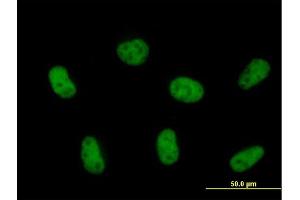 Immunofluorescence of purified MaxPab antibody to ZCCHC8 on HeLa cell. (ZCCHC8 antibody  (AA 1-707))