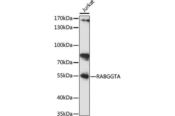 RABGGTA antibody  (AA 240-360)