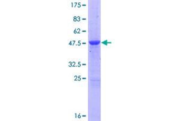 MOBKL1A Protein (AA 1-216) (GST tag)