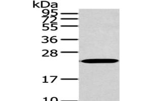 Western Blot analysis of 293T cells using ARL2 Polyclonal Antibody at dilution of 1/200