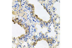 Immunohistochemistry of paraffin-embedded mouse lung using IGF1R antibody (ABIN5970073) at dilution of 1/100 (40x lens). (IGF1R antibody  (N-Term))