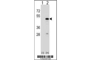 Western blot analysis of RBM22 using rabbit polyclonal RBM22 Antibody using 293 cell lysates (2 ug/lane) either nontransfected (Lane 1) or transiently transfected (Lane 2) with the RBM22 gene. (RBM22 antibody  (AA 165-193))