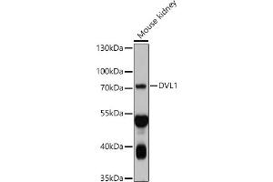 Western blot analysis of extracts of Mouse kidney, using DVL1 antibody (ABIN7266796) at 1:1000 dilution. (DVL1 antibody  (AA 510-640))