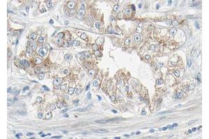 AF3132 at 1/100 staining human Prostate tissue sections by IHC-P. (PDGFRB antibody  (pTyr1021))