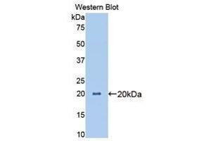 Western Blotting (WB) image for anti-Angiopoietin-Like 4 (ANGPTL4) (AA 227-389) antibody (ABIN3207379) (ANGPTL4 antibody  (AA 227-389))