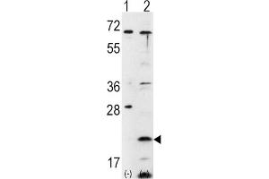 Western Blotting (WB) image for anti-Frataxin (FXN) antibody (ABIN3002642) (Frataxin antibody)