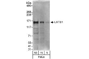 anti-LATS, Large Tumor Suppressor, Homolog 1 (Drosophila) (LATS1) (C-Term) antibody