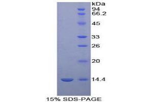SDS-PAGE (SDS) image for D-Aspartate Oxidase (DDO) (AA 161-272) protein (His tag) (ABIN1099030)