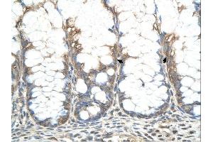 CHIC2 antibody was used for immunohistochemistry at a concentration of 4-8 ug/ml. (CHIC2 antibody  (N-Term))