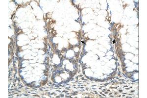 CHIC2 antibody was used for immunohistochemistry at a concentration of 4-8 ug/ml.