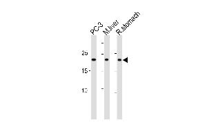 PSMB2 Antibody (C-term) (ABIN1881696 and ABIN2843611) western blot analysis in PC-3 cell line,mouse liver and rat stomach tissue lysates (35 μg/lane). (PSMB2 antibody  (C-Term))