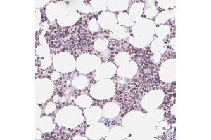 Immunohistochemical staining (Formalin-fixed paraffin-embedded sections) of human bone marrow with VPREB1 polyclonal antibody  shows moderate nuclear membrane positivity in hematopoietic cells. (VPREB1 antibody  (AA 20-138))