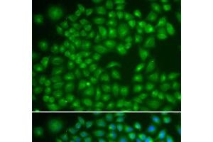 Immunofluorescence analysis of MCF-7 cells using RAB4A Polyclonal Antibody (Rab4 antibody)