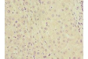 Immunohistochemistry of paraffin-embedded human liver tissue using ABIN7157750 at dilution of 1:100 (KYNU antibody  (AA 1-307))