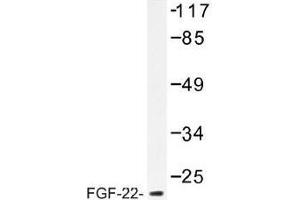 Image no. 1 for anti-Fibroblast Growth Factor 22 (FGF22) antibody (ABIN317810)