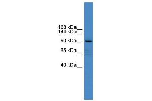 WB Suggested Anti-XYLT1 Antibody Titration:  0. (XYLT1 antibody  (Middle Region))