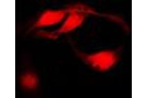 Immunofluorescent analysis of CHK1 staining in HeLa cells. (CHEK1 antibody  (Center))