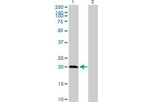 Western Blot analysis of PPCDC expression in transfected 293T cell line by PPCDC MaxPab polyclonal antibody. (PPCDC antibody  (AA 1-204))